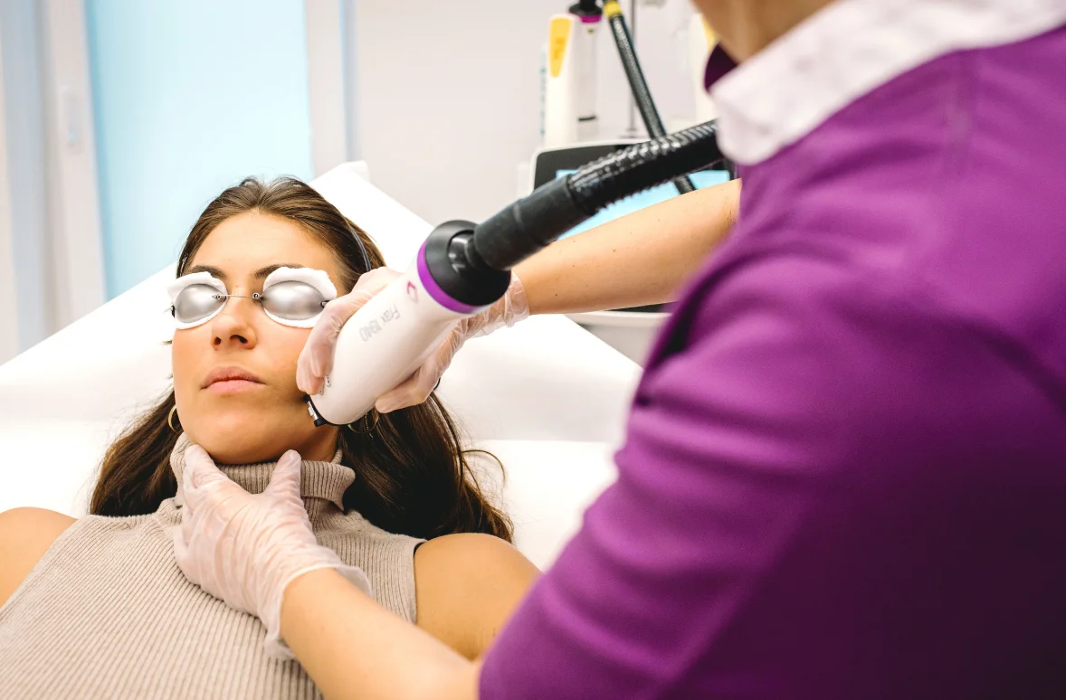 BABY FACE LASER TREATMENT