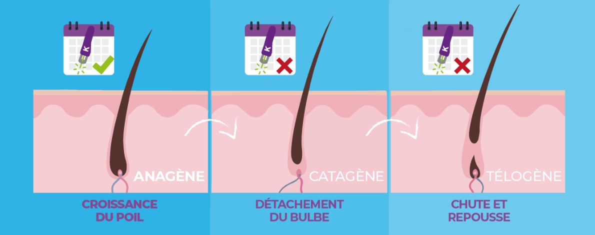 Le cycle de croissance du poil et son importance pour l'épilation laser