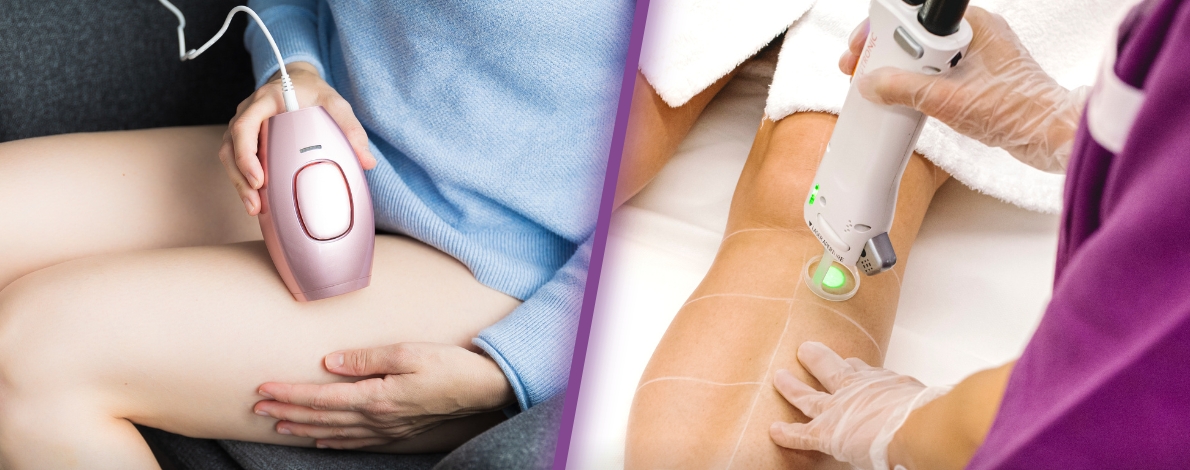 Épilation à Domicile vs. Épilation Laser Professionnelle