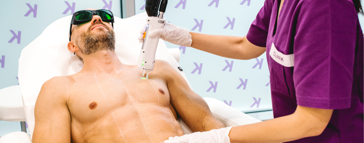 L’épilation laser pour homme : Une solution durable et efficace
